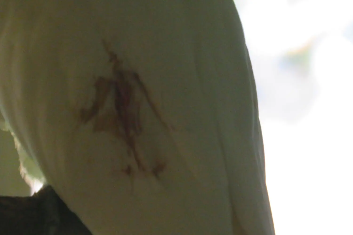 Injury Through Parrots Wing